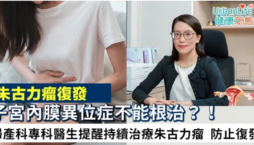 《UrbanLife Health 健康新態度》報導： 子宮內膜異位症不能根治？！ 婦產科專科醫生提醒持續治療朱古力瘤 防止復發