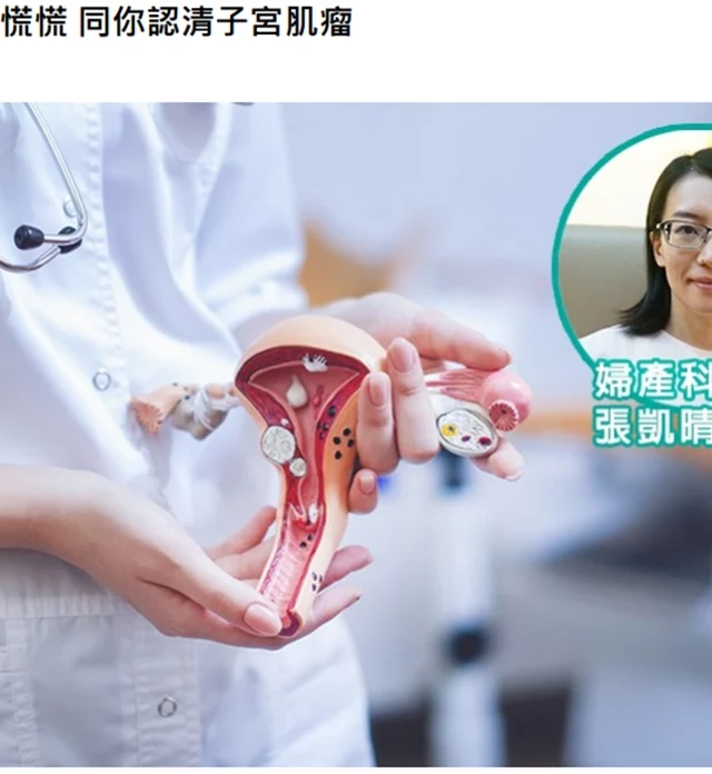 《ESDlife 生活易》報導：聽到生瘤心慌慌 同你認清子宮肌瘤