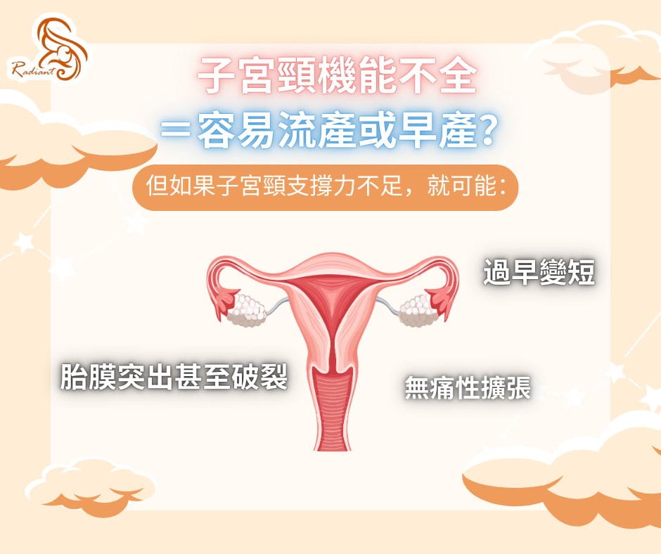 子宮頸機能不全如何影響妊娠？醫學上的治療選擇有哪些？