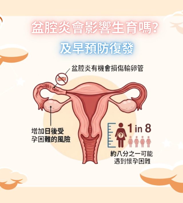 盆腔炎會影響生育嗎？及早預防復發