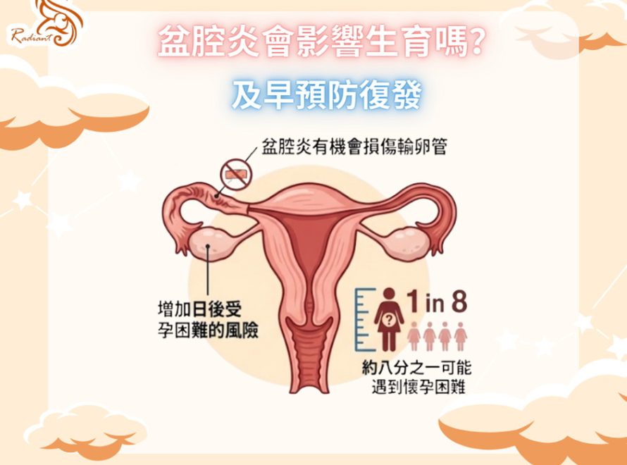 盆腔炎會影響生育嗎?及早預防復發