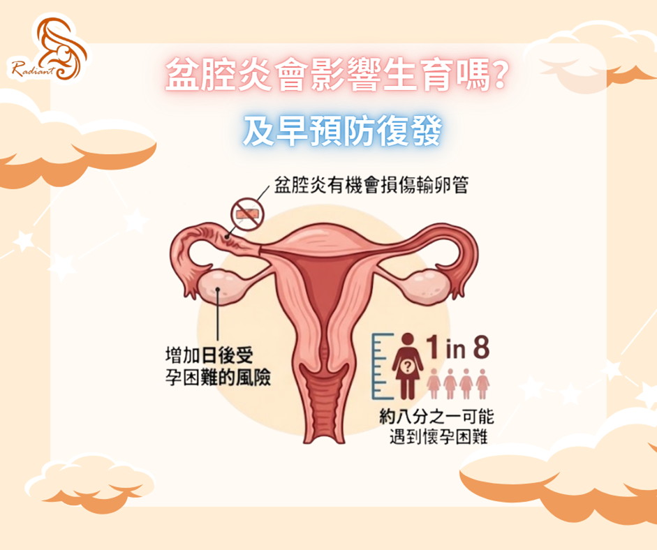 盆腔炎會影響生育嗎?及早預防復發
